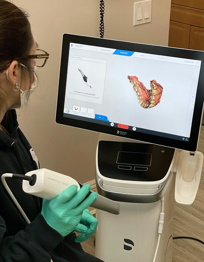 digital intraoral scans