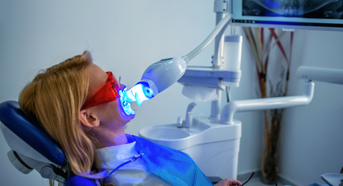 Before and After Image of Whitened Teeth